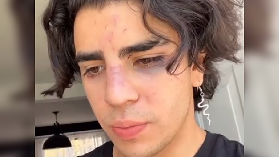 Aaronmercury denunció haber sido víctima de agresiones tras acudir a un antro llamado Pepe el Toro, ubicado la plaza comercial Jurica en Querétaro
