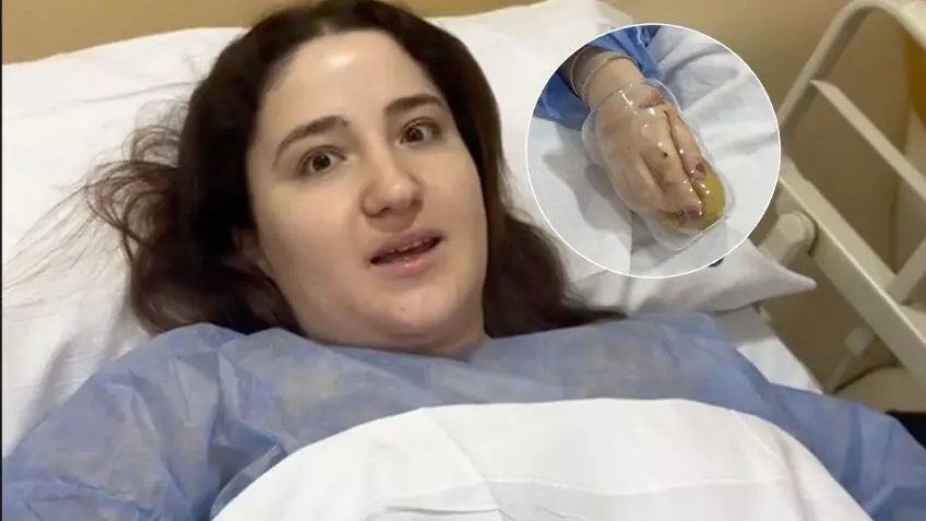 La joven argentina documentó el accidente doméstico y en su perfil de TikTok ya se presenta como “La chica del vaso”