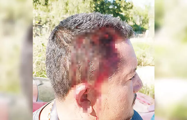 Un hombre lesionado y cuantiosos daños materiales dejó un aparatoso choque por alcance con proyección que se registró la mañana de ayer.