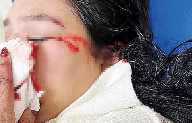 Una joven madre de familia fue trasladada de emergencia a la Cruz Roja