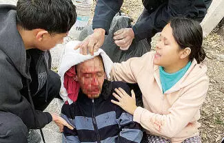 Un menor de edad, entre los lesionados de la gresca