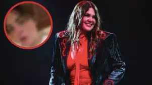 La cantante mostró sus lesiones en redes sociales y pidió ayuda de algún experto