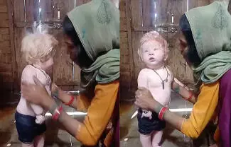 Un evento extraordinario ha captado la atención en una región de la India, donde el nacimiento de un pequeño ha sido interpretado por los habitantes locales como un suceso místico. 