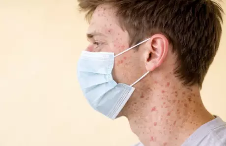  La Secretaría de Salud reporta que los niños menores de un año presentan la mayor tasa de incidencia.