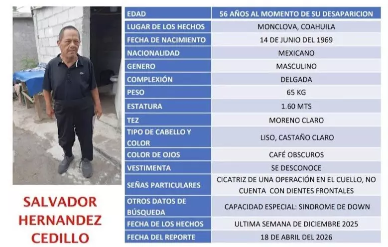 Como señas particulares, presenta una cicatriz de operación en el cuello y ausencia de dientes frontales. 