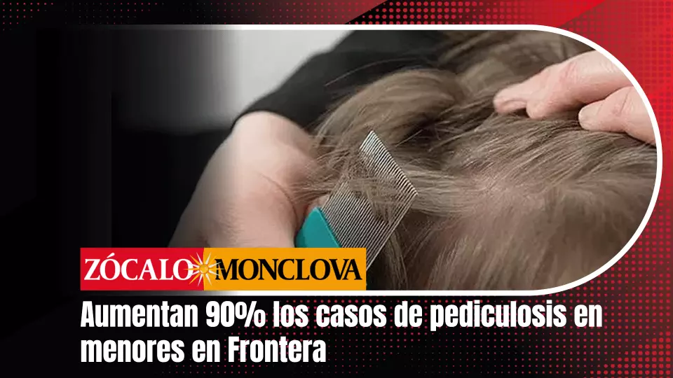 Esta problemática se presenta en personas de todos los géneros, pero principalmente en niñas, ya que suelen tener el cabello largo, lo que facilita la propagación de los piojos