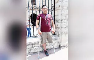 Perdió su pierna izquierda en un accidente el pasado 27 de octubre, le hace falta una prótesis para ser más funcional
